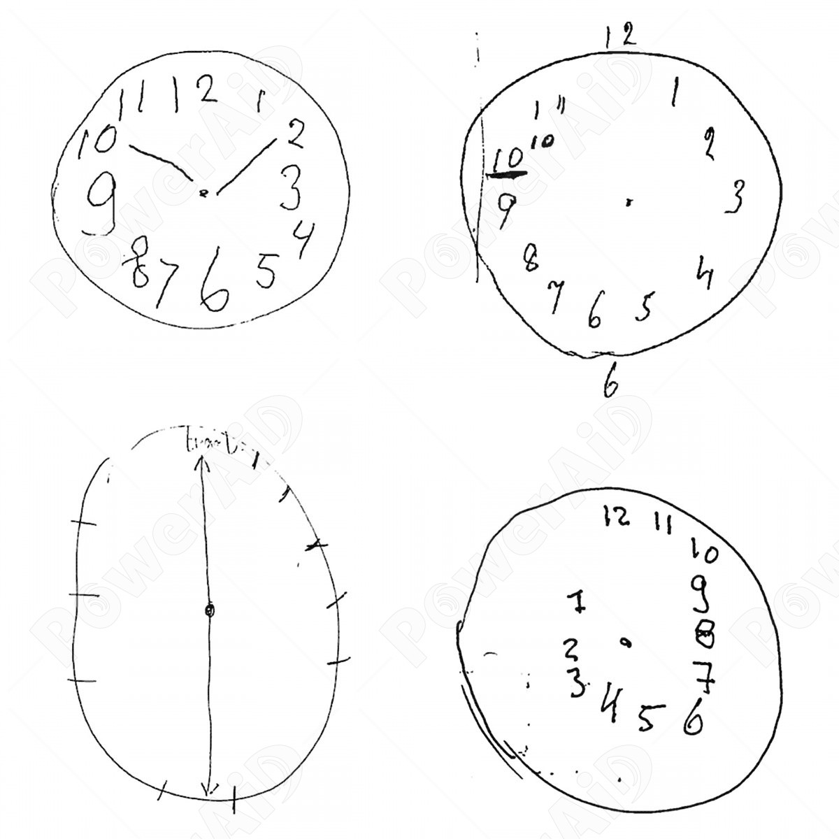 Orologio Digitale Per Demenza Con Display 8'' E 8 Sveglie – Calendario Giornaliero Extra Large, Per Anziani Con Perdita Di Memoria E Problemi Di Vista