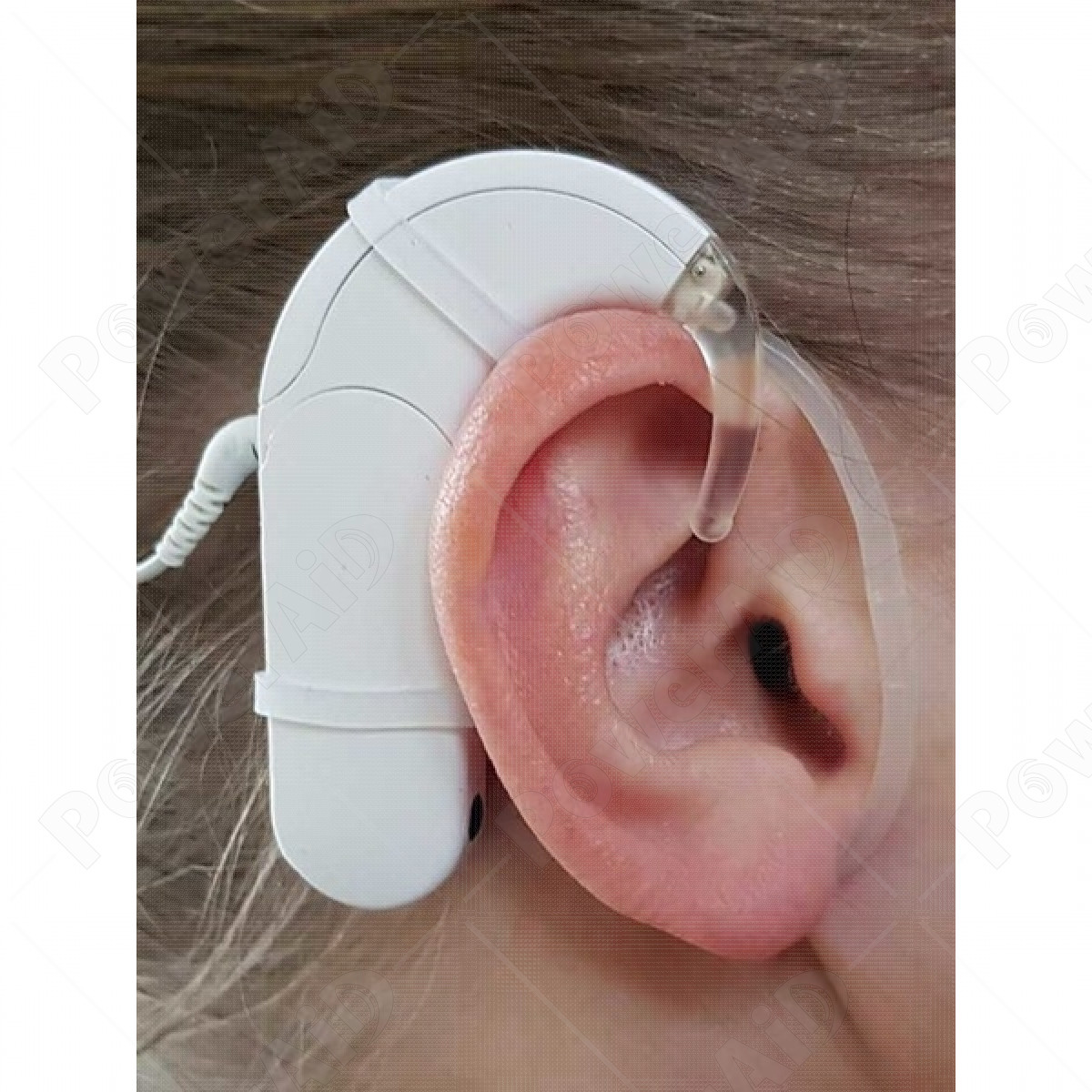 SmartEAR - Sistema Anticaduta 7 mm 